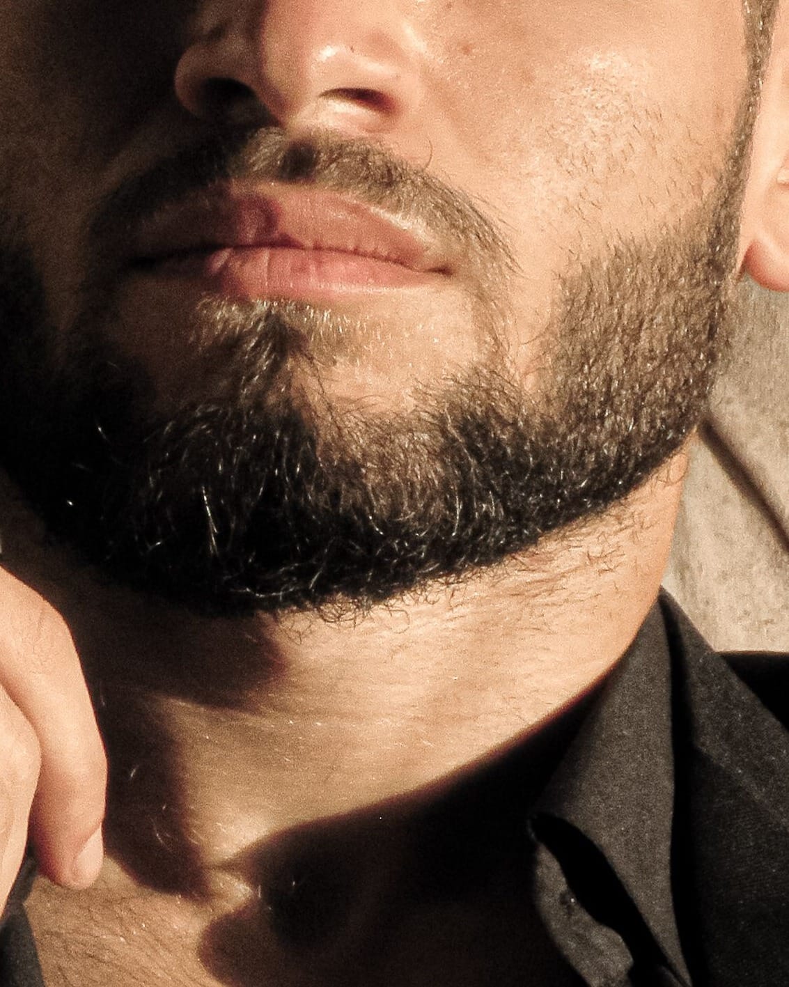 Trapianto di barba a Roma, dettaglio di una barba